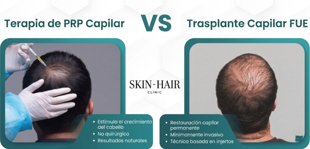PRP vs trasplante capilar: ¿qué tratamiento deberías elegir?