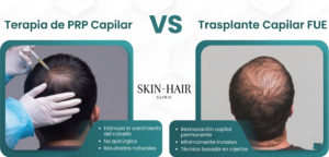 PRP vs trasplante capilar: ¿qué tratamiento deberías elegir?